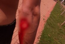 Jovem é atacado por piranha no Lado de Morzalândia