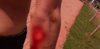 Jovem é atacado por piranha no Lado de Morzalândia