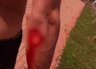 Jovem é atacado por piranha no Lado de Morzalândia